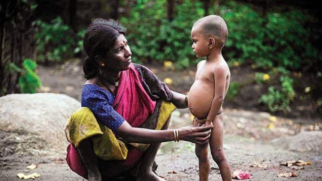 एनीमिया से मुक्ति के लिए 'महुआ लड्डू' का सहारा! टास्कफोर्स का अनोखा निर्देश