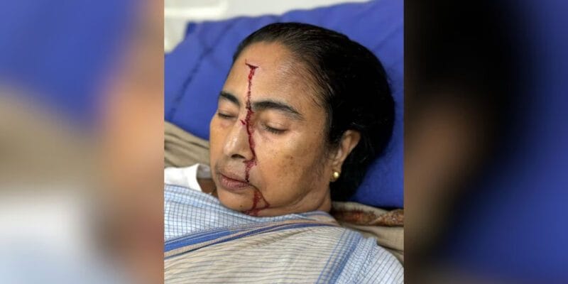 घर पर टहलते समय गिरने से घायल हुईं सीएम ममता, सिर में लगे चार टांके