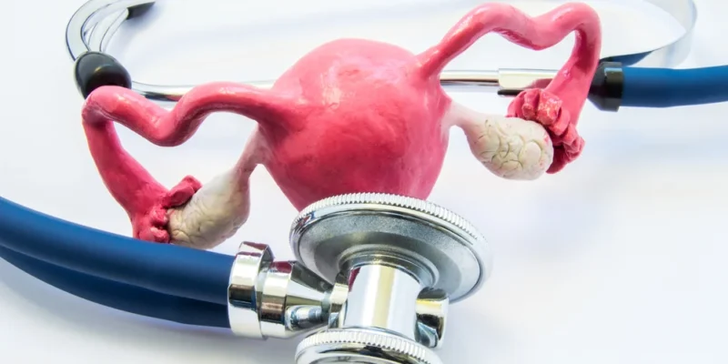 सालों का दर्द खत्म! महिला के गर्भाशय से निकाली गईं 250 गांठें, डॉक्टर भी हुए हैरान 1 सालों का दर्द खत्म! महिला के गर्भाशय से निकाली गईं 250 गांठें, डॉक्टर भी हुए हैरान