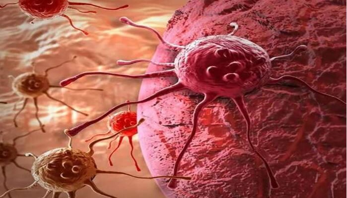 Cancer Case In India