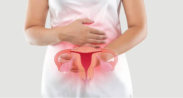 Ovarian Cancer