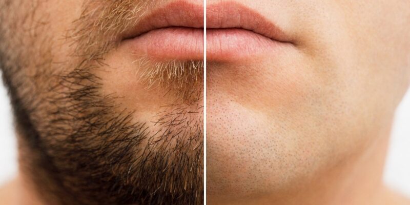 Daily Shaving Harmful or Beneficial: क्या आप करते हैं रोजाना शेविंग, जानें कितनी बार बनाना चाहिए दाढ़ी