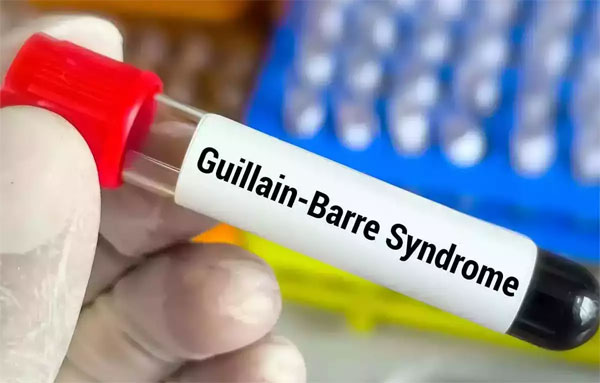GBS Outbreak in Maharashtra: महाराष्ट्र में GBS का प्रकोप जारी, 163 मामलों में 127 की पुष्टि 1 GBS Outbreak in Maharashtra: महाराष्ट्र में GBS का प्रकोप जारी, 163 मामलों में 127 की पुष्टि