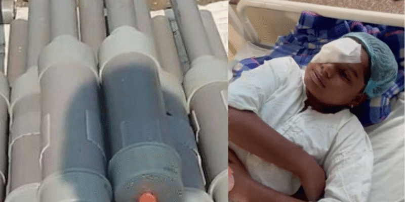 कार्बाइड गन ने छीनी बच्चों समेत सैकड़ों के आंखों की रोशनी, MP में 300 से अधिक घायल 1 कार्बाइड गन