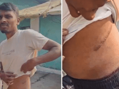 Organ Trafficking: साहूकारों ने किसान को कंबोडिया भेजकर बिकवाई किडनी; अब सरकार लाएगी सख्त कानून 2 Organ Trafficking