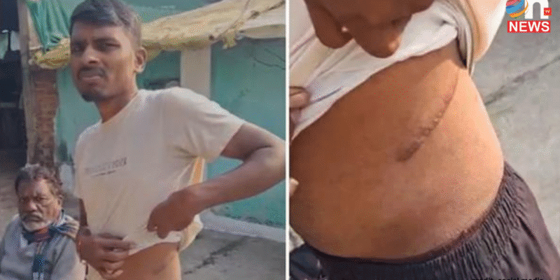 Organ Trafficking: साहूकारों ने किसान को कंबोडिया भेजकर बिकवाई किडनी; अब सरकार लाएगी सख्त कानून 1 Organ Trafficking