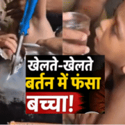 केरल में खेल-खेल में बड़ा हादसा: एल्यूमिनियम के बर्तन में फंसा बच्चा, रेस्क्यू टीम ने सुरक्षित निकाला