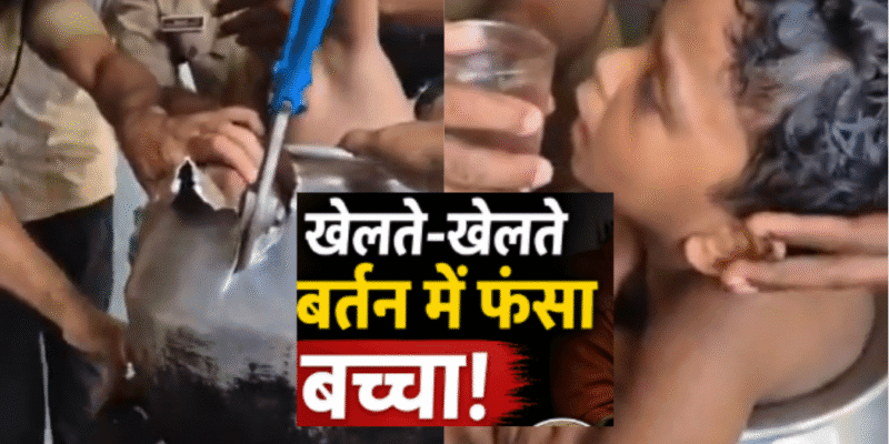 केरल में खेल-खेल में बड़ा हादसा: एल्यूमिनियम के बर्तन में फंसा बच्चा, रेस्क्यू टीम ने सुरक्षित निकाला