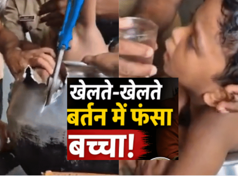 केरल में खेल-खेल में बड़ा हादसा: एल्यूमिनियम के बर्तन में फंसा बच्चा, रेस्क्यू टीम ने सुरक्षित निकाला